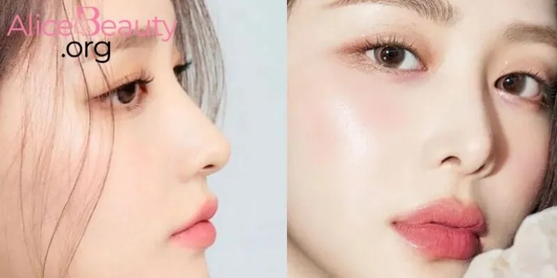 cẩm nang dành cho nàng sau khi nâng mũi