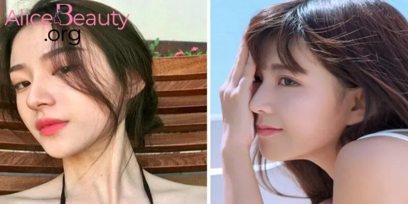 Nâng mũi không chỉ là xu hướng mà còn là “vũ khí bí mật” giúp nàng tỏa sáng