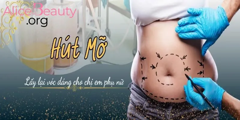Bóc mỡ định hình cơ thể với những đường cong mềm mại, cân đối