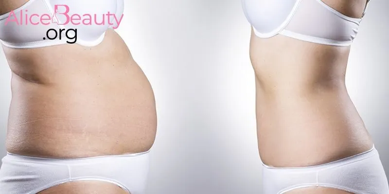 Bóc mỡ còn góp phần nâng cao sức khỏe tổng thể một cách bất ngờ và thiết thực