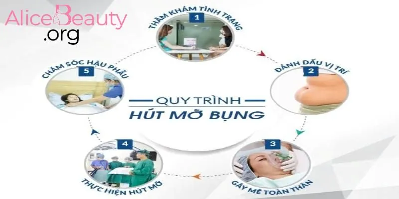 Alice Beauty áp dụng quy trình chuẩn y khoa cho dịch vụ bóc mỡ