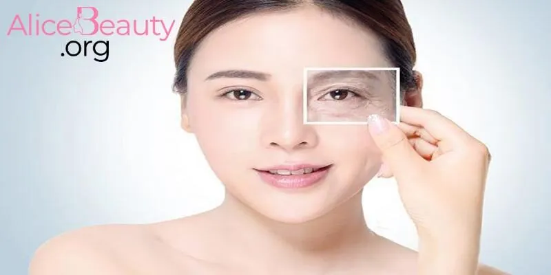 Làn da săn chắc hơn khi tiêm botox tại Alice Beauty