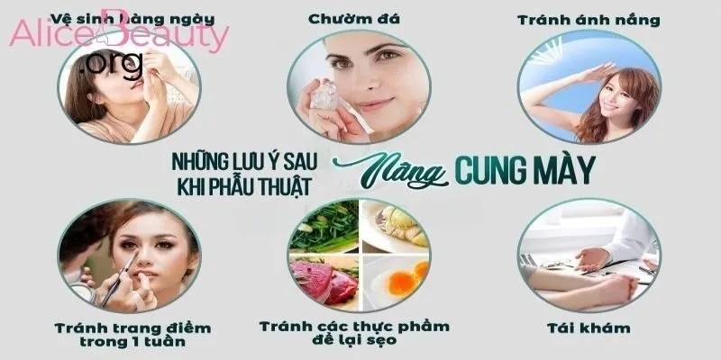 Vệ sinh sau nâng cung không phức tạp nhưng cần làm đúng