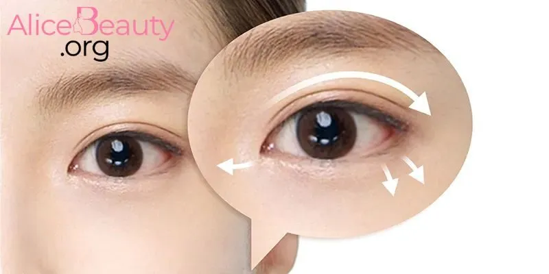 Cắt mí là cứu tinh cho các nàng mắt một mí hay mí sụp muốn nâng cấp thần thái.