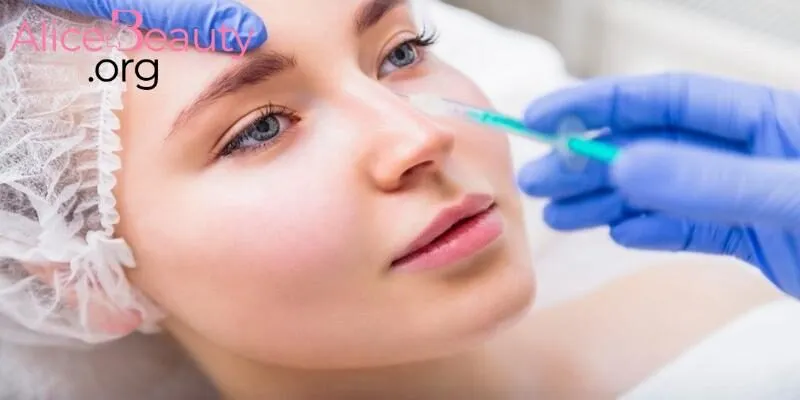 Filler là một loại chất làm đầy được sử dụng trong làm đẹp