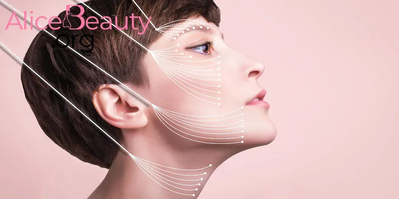 cấy chỉ Collagen