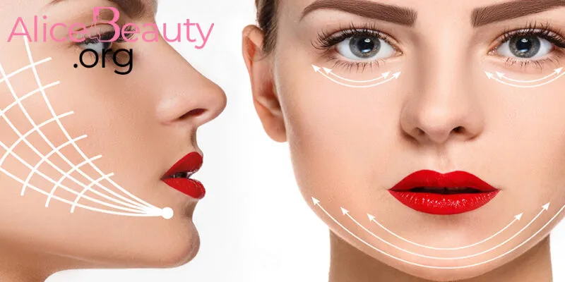 Tác dụng rõ rệt nhất sau cấy chỉ Collagen là nâng cơ, cải thiện các vùng da trùng, chảy xệ trên mặt