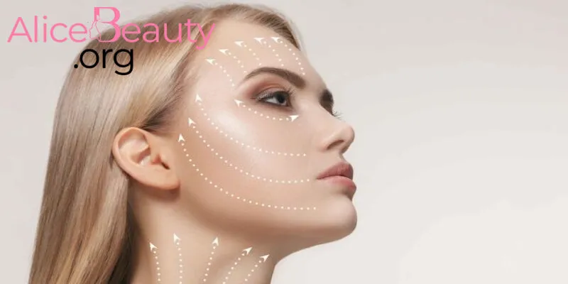 Cấy chỉ Collagen có tác dụng chính là nâng cơ mặt, trẻ hóa da