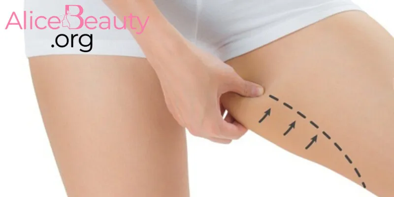 Dịch vụ thon gọn đùi, bắp chân sẽ giúp bạn sở hữu đôi chân nuột nà nhanh chóng