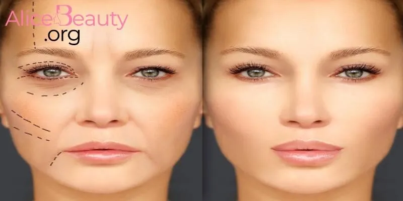 Alice Beauty cung cấp đa dạng các dịch vụ tiểu phẫu làm đẹp an toàn