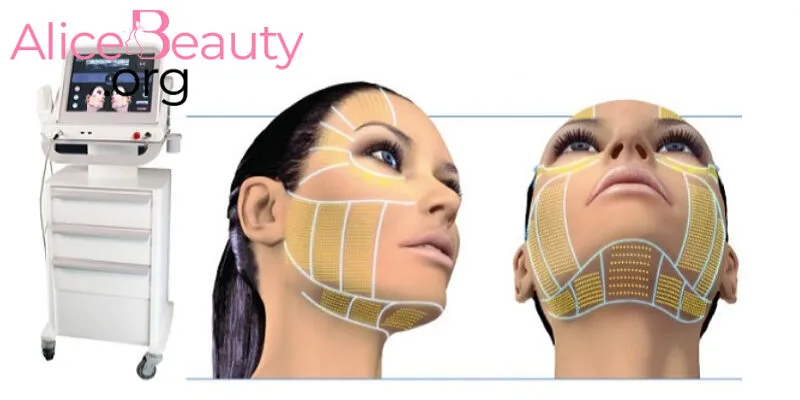 Công nghệ HIFU rất an toàn, không gây tác dụng phụ, không cần nghỉ dưỡng sau thực hiện
