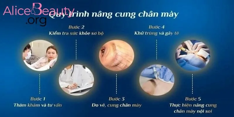 Quy trình nâng cung được thực hiện theo tiêu chuẩn nghiêm ngặt tại Alice Beauty