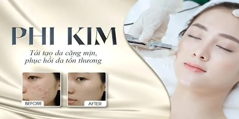 Phi kim giúp da sáng lên trông thấy chỉ sau một lần thực hiện