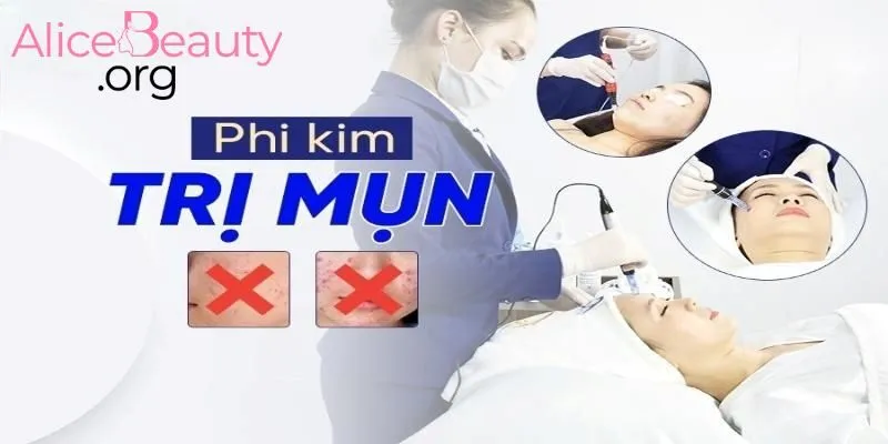 Phi kim làm thông thoáng lỗ chân lông giảm mụn ẩn và hỗ trợ làm mờ sẹo rỗ rõ rệt