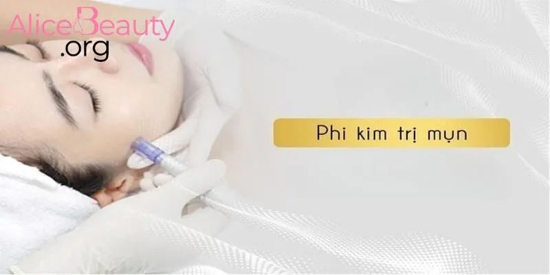 Liệu pháp phi kim được thực hiện theo quy trình chuẩn tại Alice Beauty