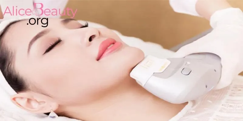 HIFU – công nghệ nâng cơ, giúp da săn chắc