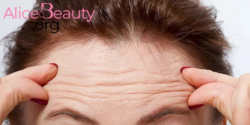 Hiểu rõ có phương pháp và hiệu quả xóa nhăn là gì sẽ giúp bạn có lựa chọn để duy trì làn da tươi trẻ